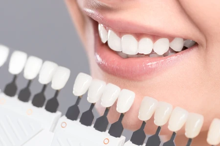 Bí quyết chăm sóc răng sau khi tẩy trắng