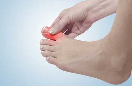 Nguyên nhân, triệu chứng và cách điều trị bệnh gout