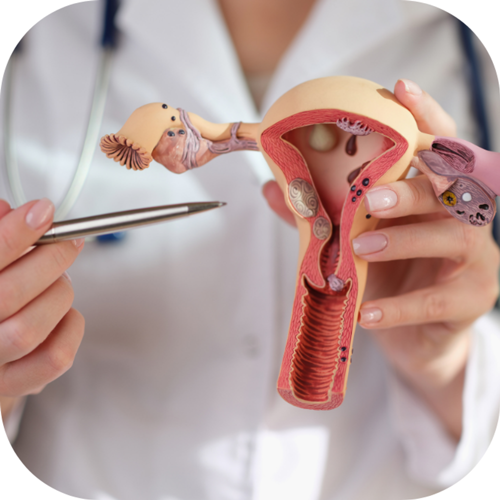 u nang buồng trứng