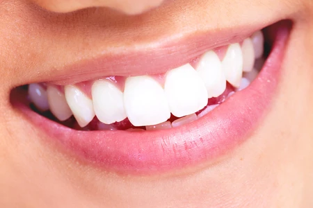 Dừng ngay 3 thói quen này lại nếu không muốn răng bạn bị hỏng
