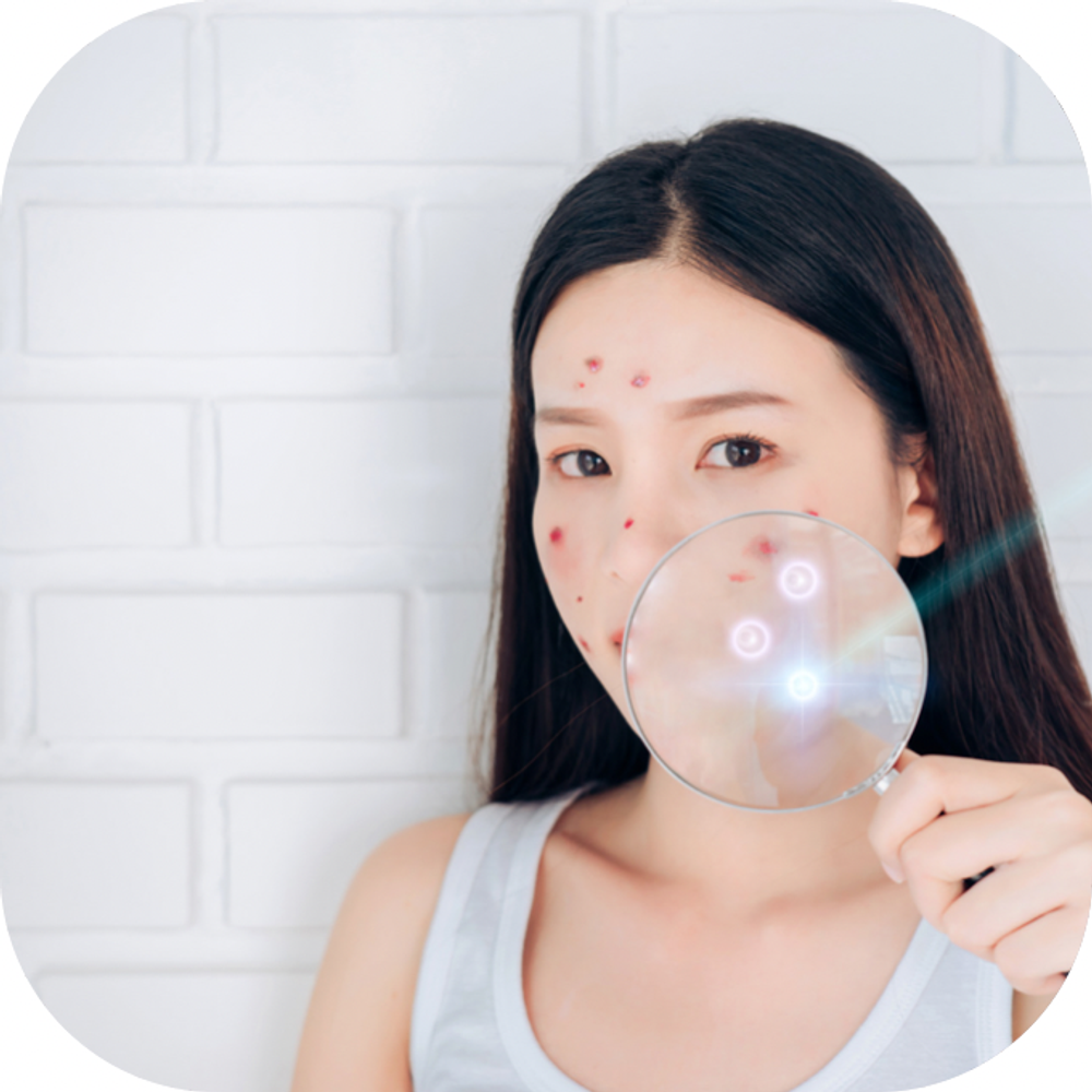 Phân biệt các loại mụn trên da và cách chăm sóc da mụn kingfoodmart