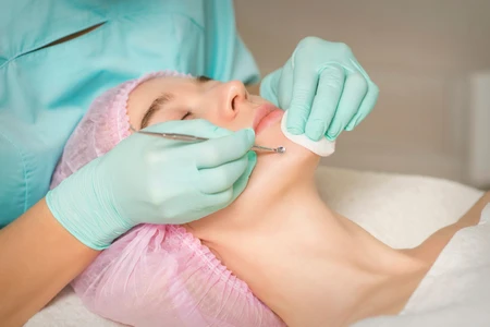 Liệu mụn đầu đen có phải là nguyên nhân tạo thành nốt ruồi trên mặt?