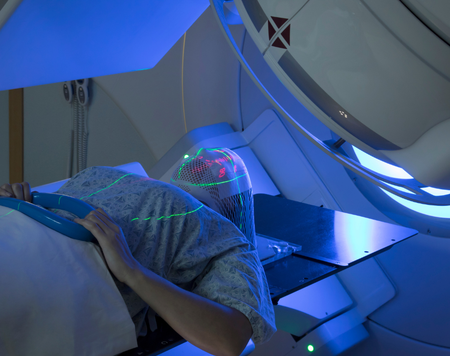 Kiến thức cần biết về xạ trị ung thư cổ tử cung