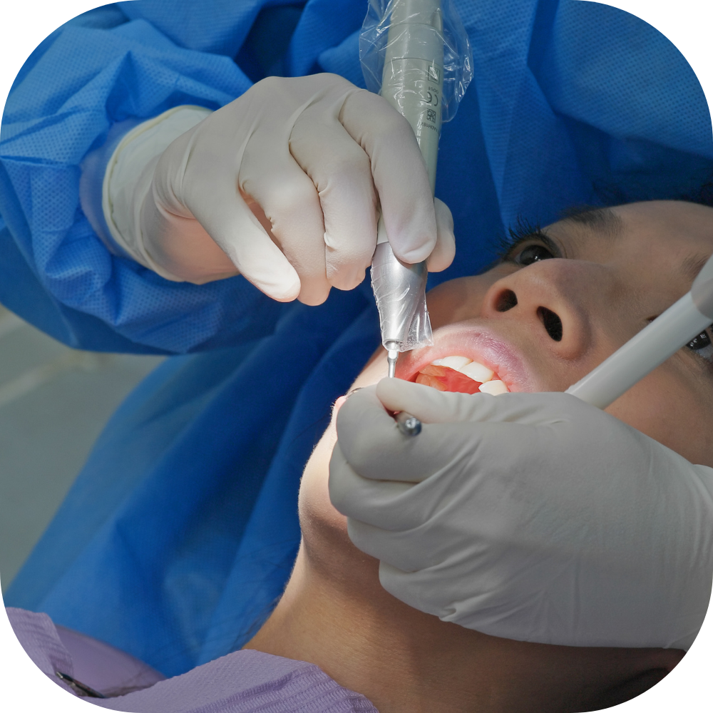 Cách điều trị tình trạng chân răng bị đen