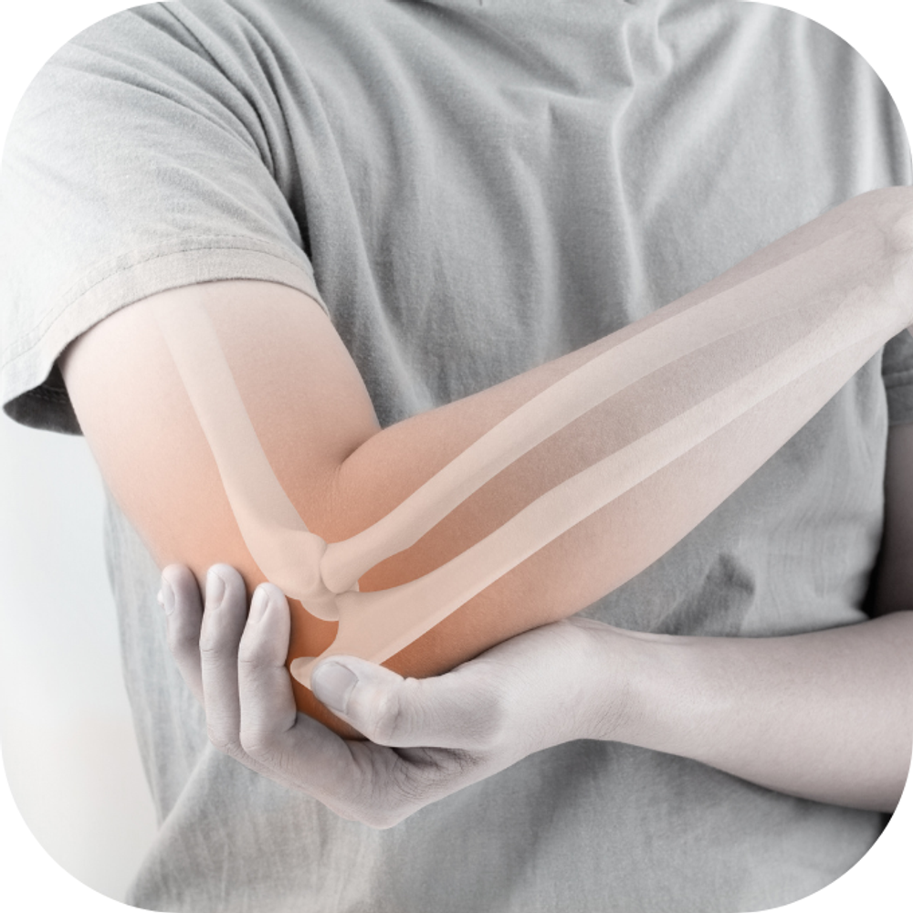 xương khớp yếu