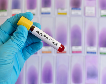 Gợi ý chế độ ăn cho bệnh nhân viêm gan C