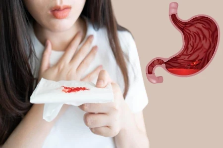 Xuất huyết dạ dày nên ăn gì
