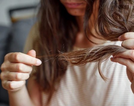 Nguyên nhân và cách phòng ngừa rụng tóc tuổi dậy thì