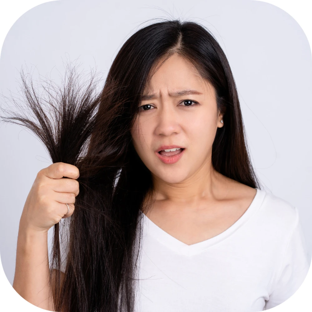 rụng tóc