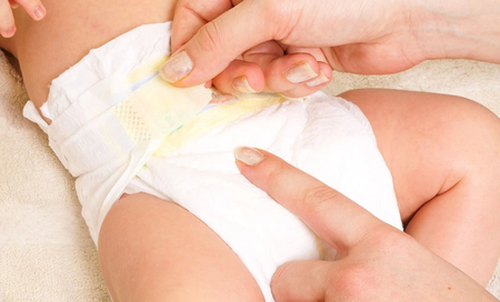 Hướng dẫn chữa hăm tã cho bé sơ sinh hiệu quả
