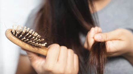 Nguyên nhận bị rụng tóc và cách hạn chế tóc rụng