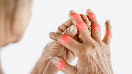Chế độ ăn uống an toàn cho người bị Gout