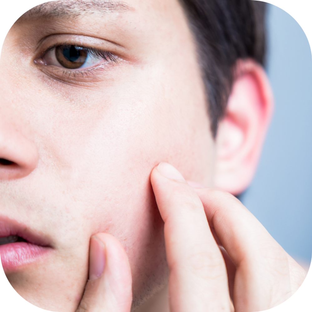 Da mặt nam giới Kingfoodmart