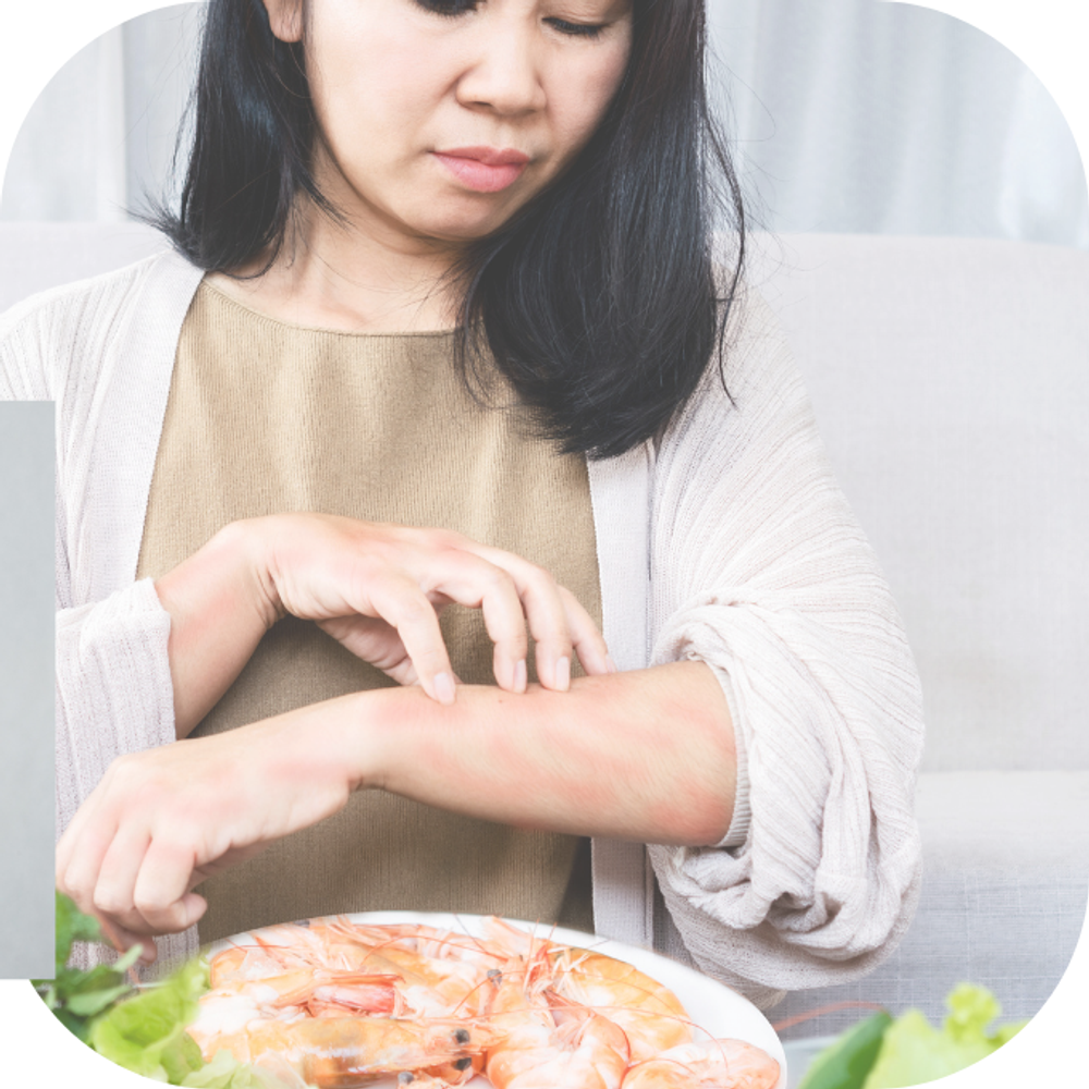 Phản ứng dị ứng - Nguyên nhân phổ biến gây sưng môi Kingfoomart