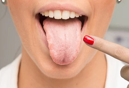 Những dấu hiệu ở lưỡi cảnh báo bệnh nguy hiểm, cần đi khám
