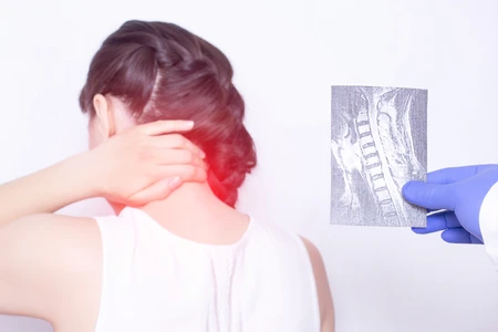 Đau nhức sau gáy có thể là dấu hiệu cho một căn bệnh
