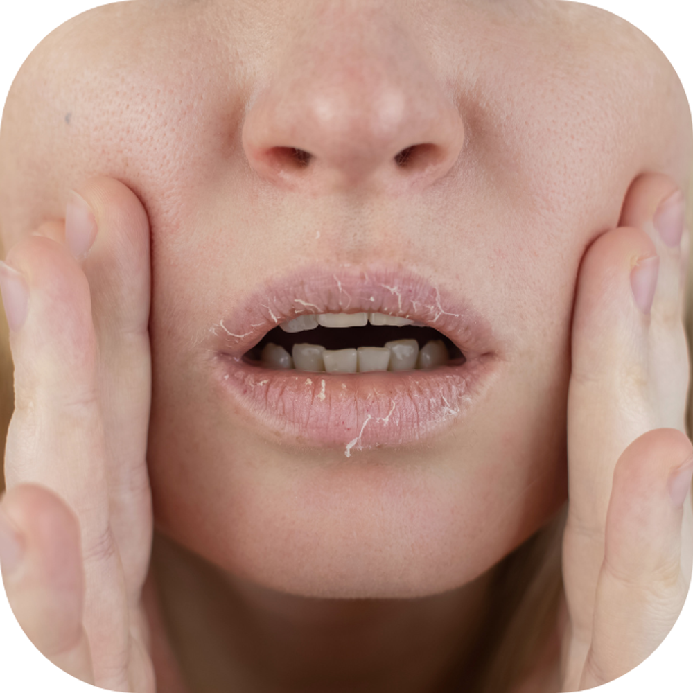 Mẹo tẩy da chết cho môi đơn giản với đường Kingfoodmart